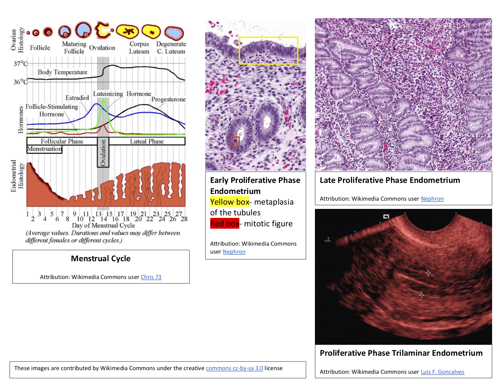 <p>Proliferative Phase Endometrium and the Menstrual Cycle