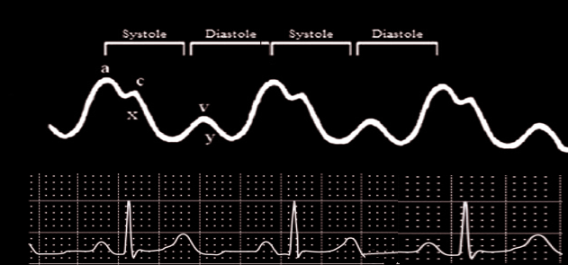 Central venous pressure