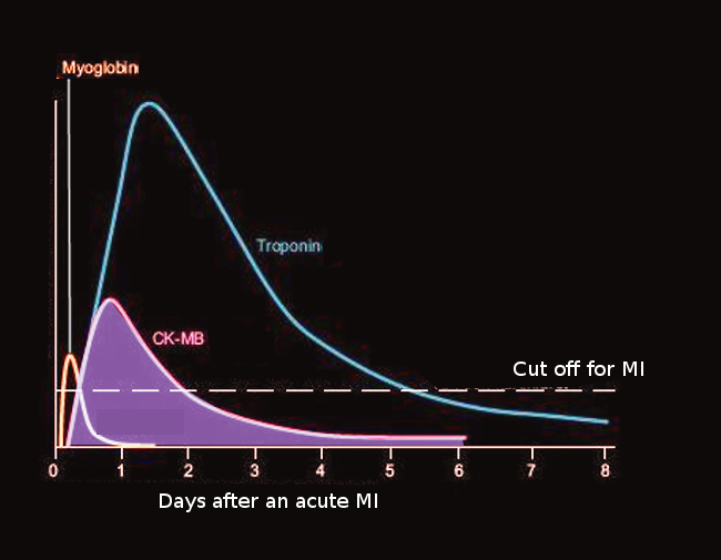 <p>Creatine Kinase Levels After a Myocardial Infarction