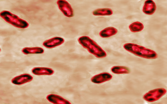 Gram stain-yersinia