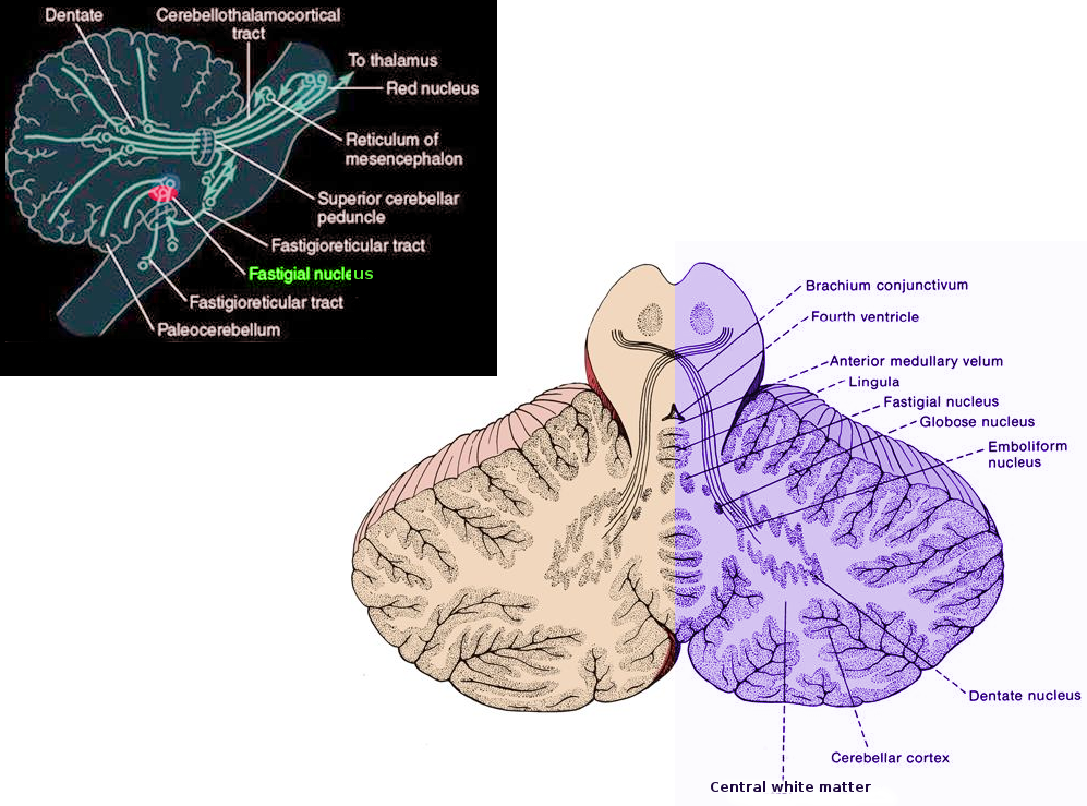 Fastigial nucleus