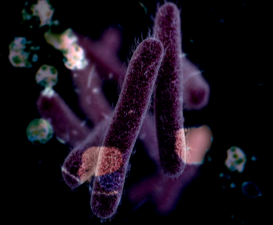 Shigella organisms