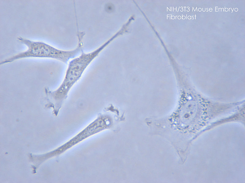 Fibroblasts