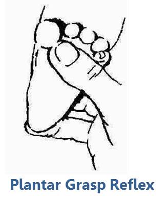 Plantar Reflex