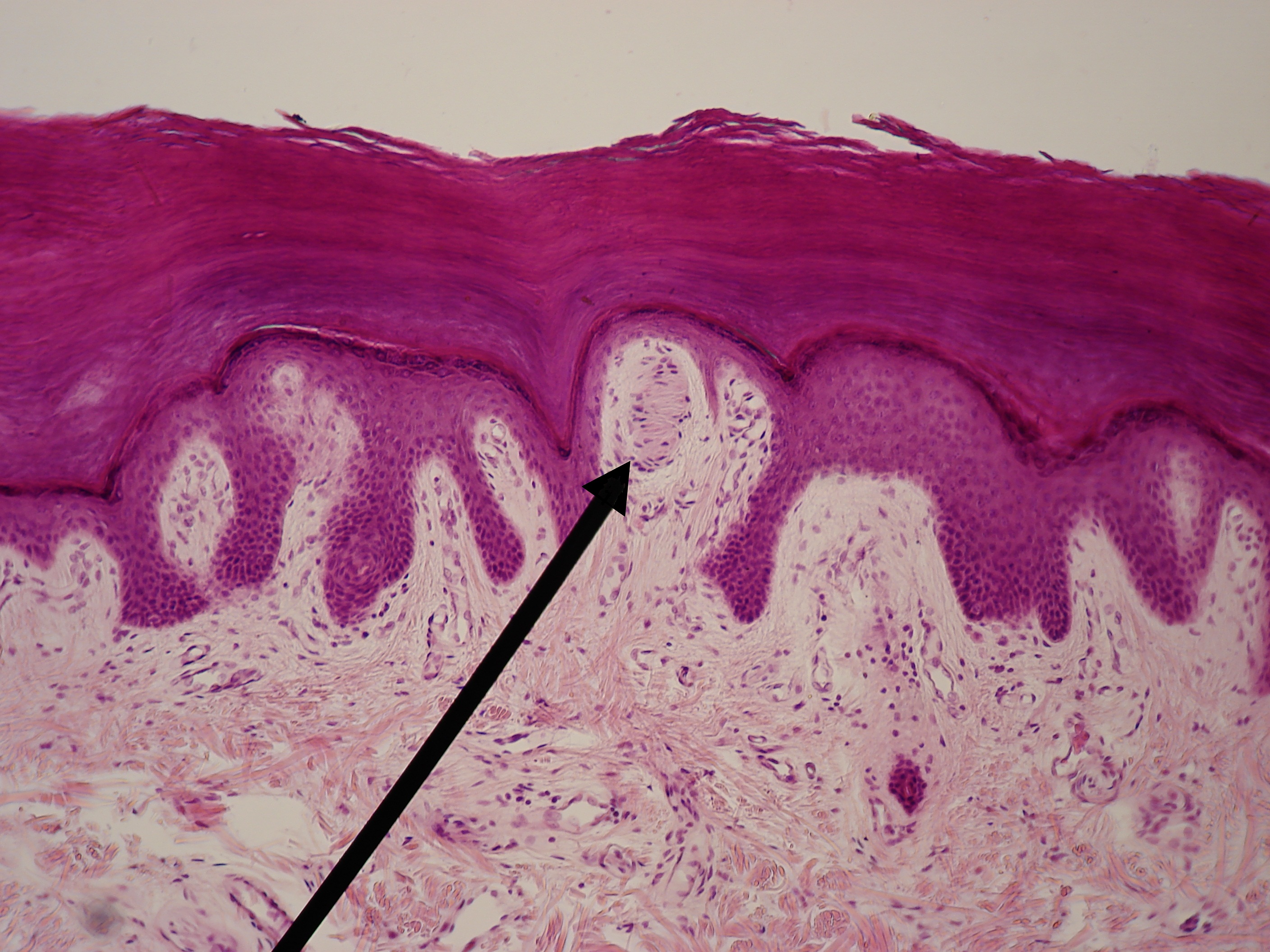 <p>Meissner Corpuscle (Tactile Corpuscle)