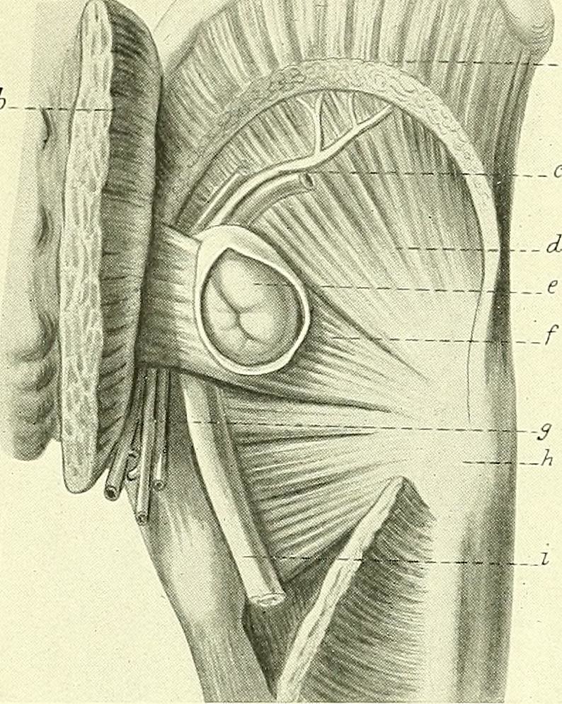 <p>Intestinal Coil. A cured sac of the obturator hernia has been opened, and an intestinal coil is seen.</p>