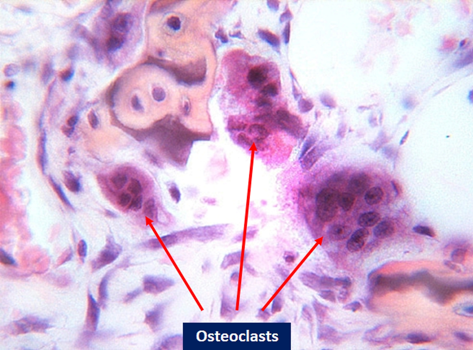 <p>The light microscope image shows the cells: osteoclasts.</p>