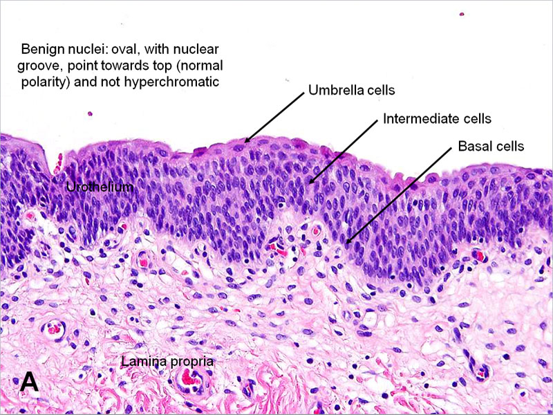 <p>Benign Urothelial Cells, Histology</p>