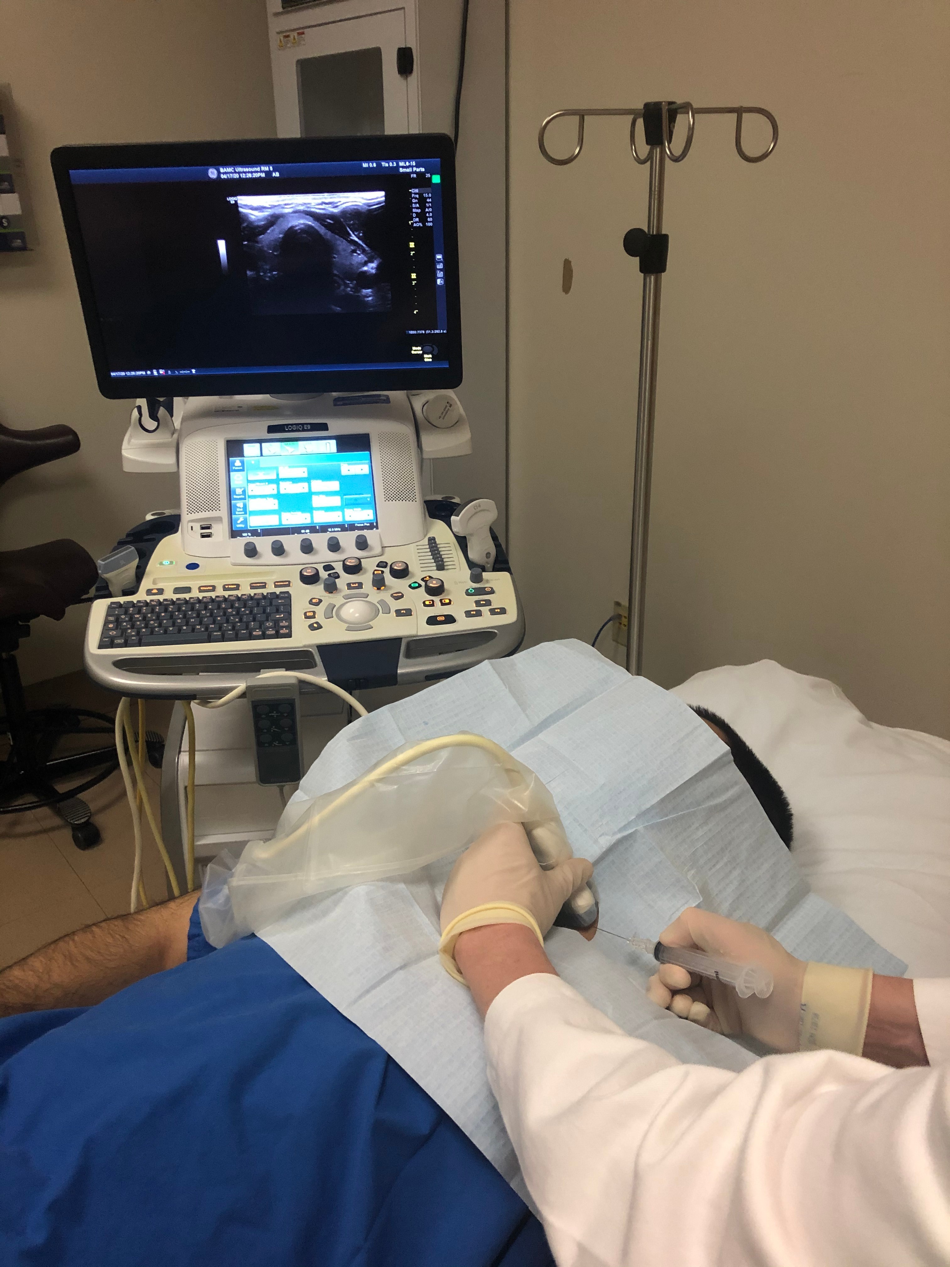 Optimal alignment with the needle, transducer, and monitor within line of sight is demonstrated.