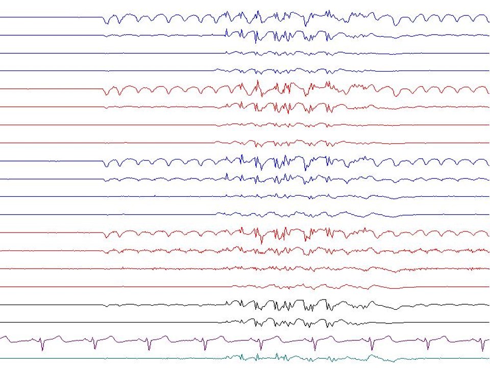 Polyspike and wave