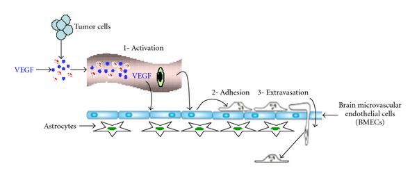 Figure one Referring PMID 21253507, Blood-brain barrier integrity and breast cancer metastasis to the brain.