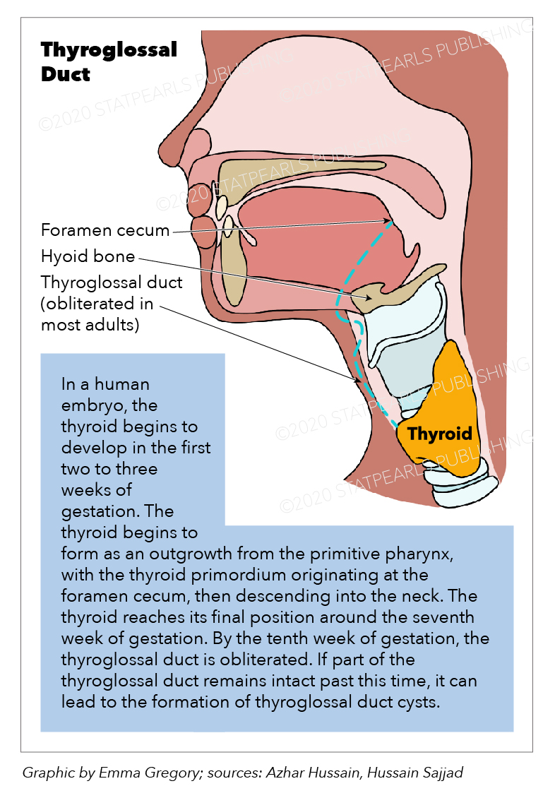 Thyroglossal duct graphic