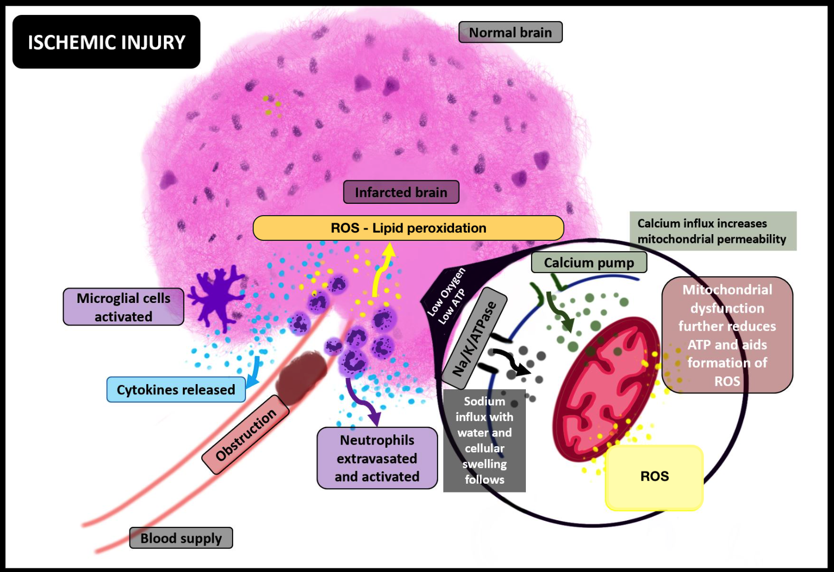 <p>Ischemic Injury and its Molecular Consequences. Abbreviation: ROS, reactive oxygen species.</p>