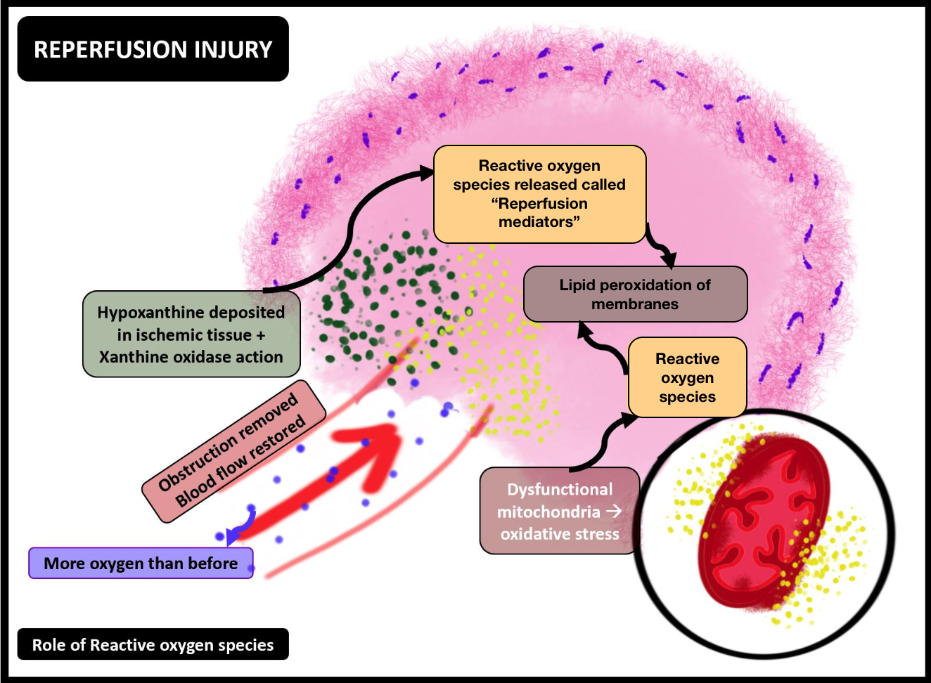 <p>Ischemia-Reperfusion Injury, Reactive Oxygen Species