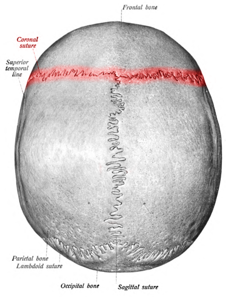 <p>Coronal Suture, Labeled