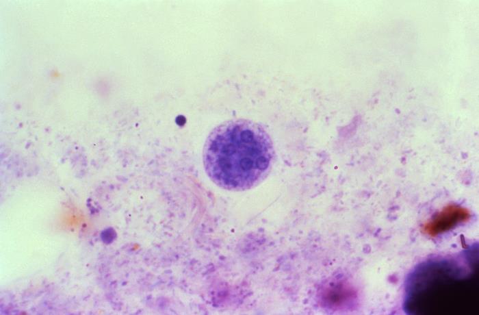 <p>Mature <em>Entamoeba coli</em> Cyst