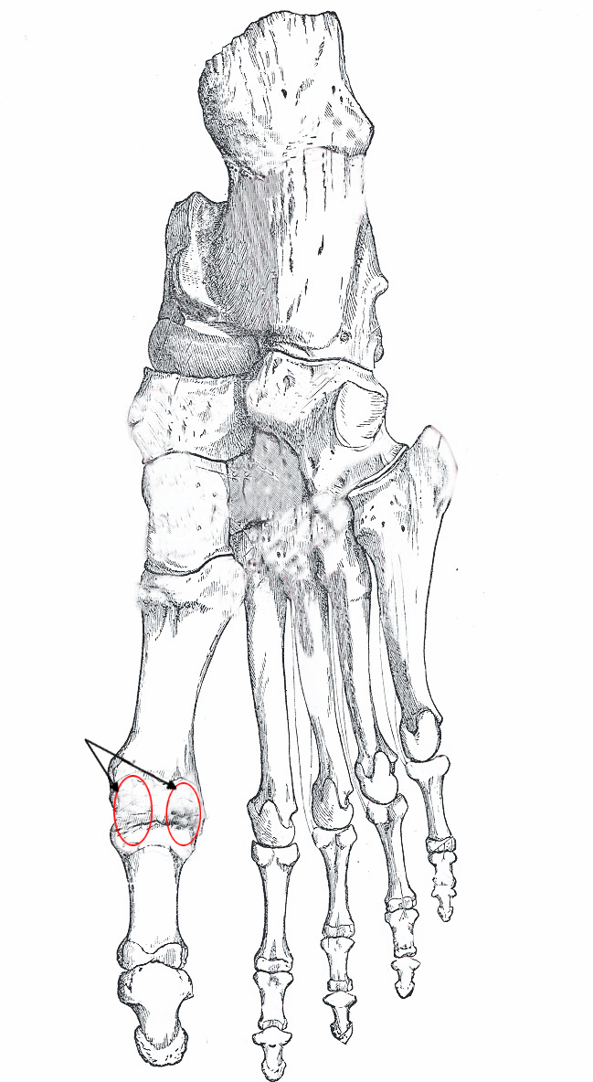 <p>Right, Foot, Bones, Plantar Surface, Calcaneus, Abductor Hallucis, Quadratus Plantar, Abductor Digiti Quinti, Talus, Navic