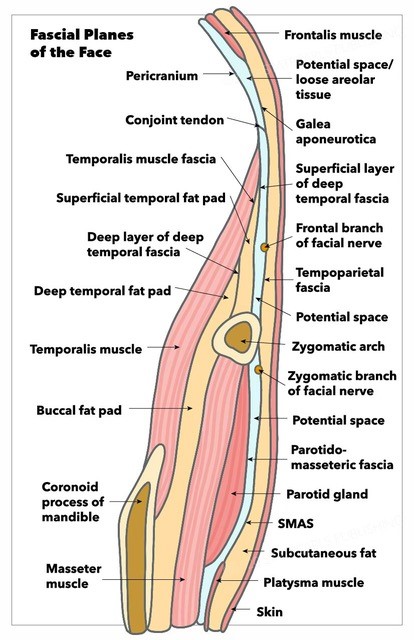 Fascial planes of the face, demonstrating continuity of frontalis muscle, galea aponeurotica, temporoparietal fascia, SMAS, and platysma, as well as location of facial nerve.