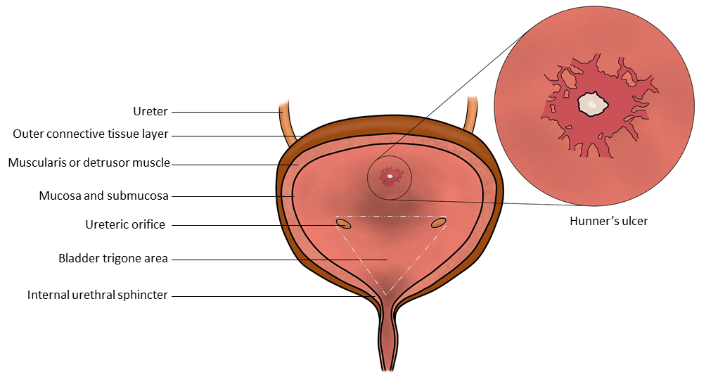 <p>Illustration of the Bladder Anatomy