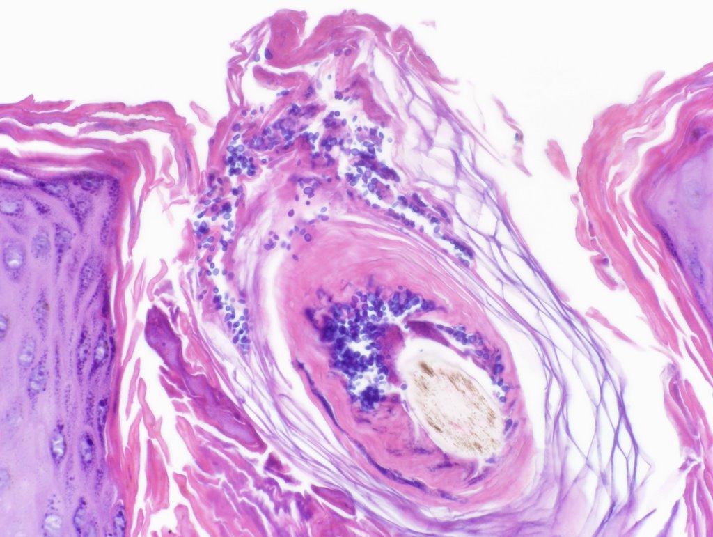 Malassezia or Pityrosporum has spherical, oval, or ellipsoidal shapes in the vegetative form. H/E 20x