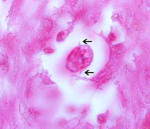 Toxocara canis larvae