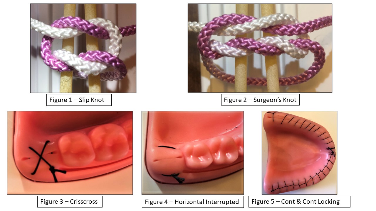 Basic Suturing Knots and Technique