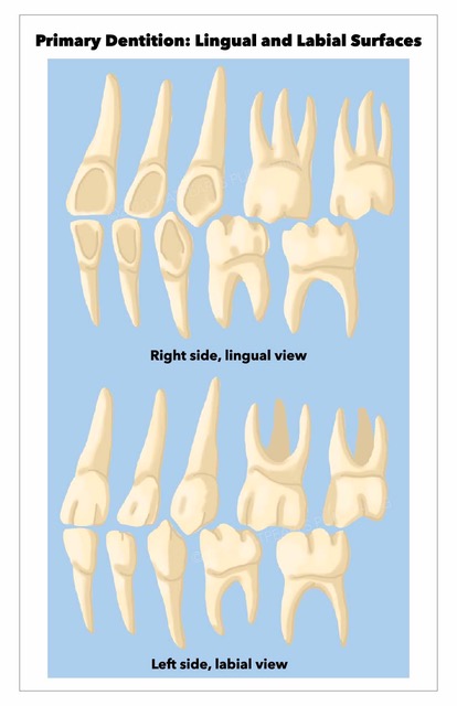 Primary Dentition, lingual and labial surfaces