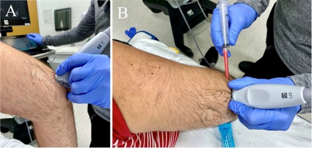 Positioning for ultrasound guided elbow arthrocentesis