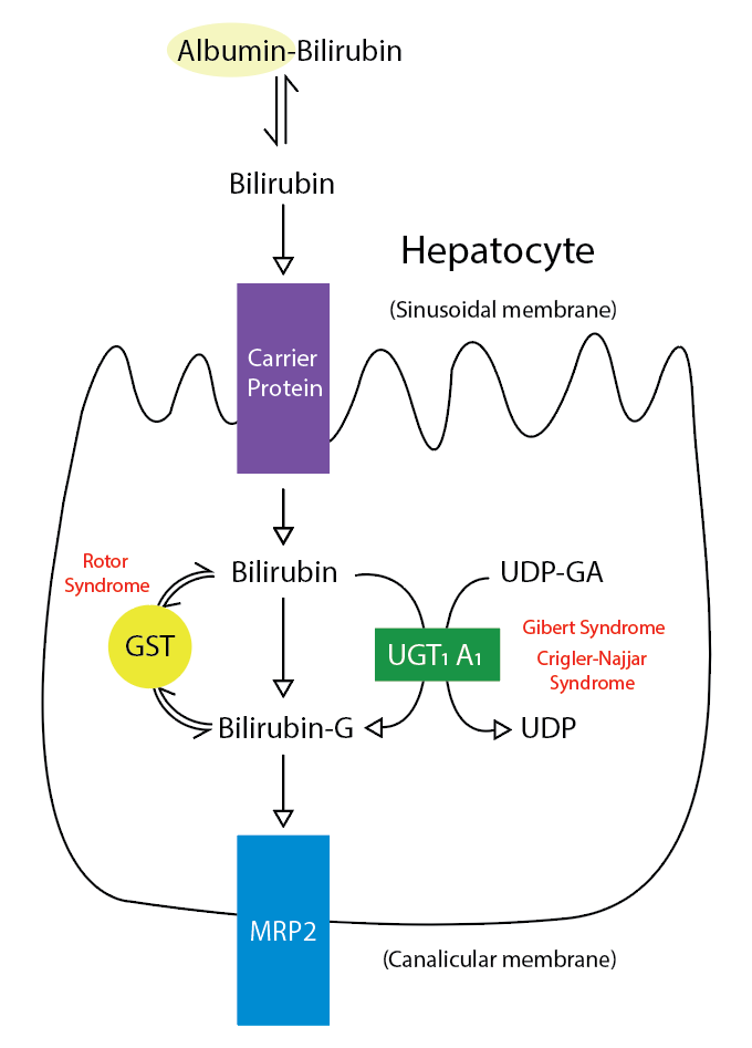 Metabolic pathway for bilirubin in the hepatocyte. Bilirubin-G corresponds to bilirubin glucuronate, where the donor is uridine diphosphate glucuronic acid (UDP-GA). This is catalyzed by the enzyme uridine diphosphate-glucuronyltransferase (UGT1A1). Gilbert and Crigler-Najjar syndrome are associated with decreases in UGT1A1 activity. Glutathione-S-transferase (GST) is a carrier protein that assists with bilirubin uptake into the cytosol and may be implicated in Rotor syndrome.
