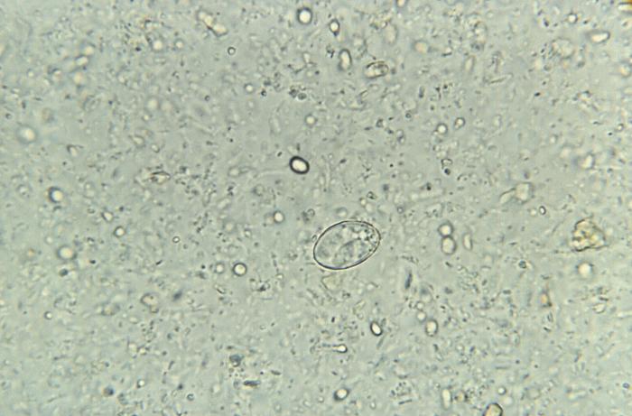 <p>Sporocyst of the Parasite, <em>Sarcocystis Hominis