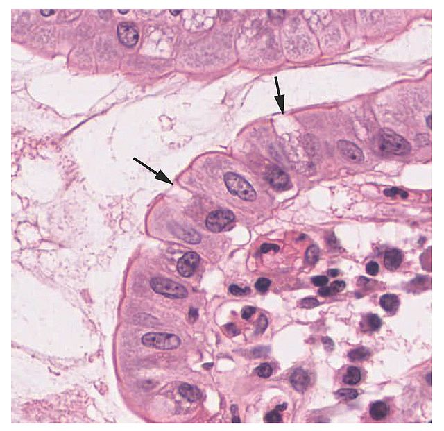 <p>Histology Showing Goblet Cells.</p>