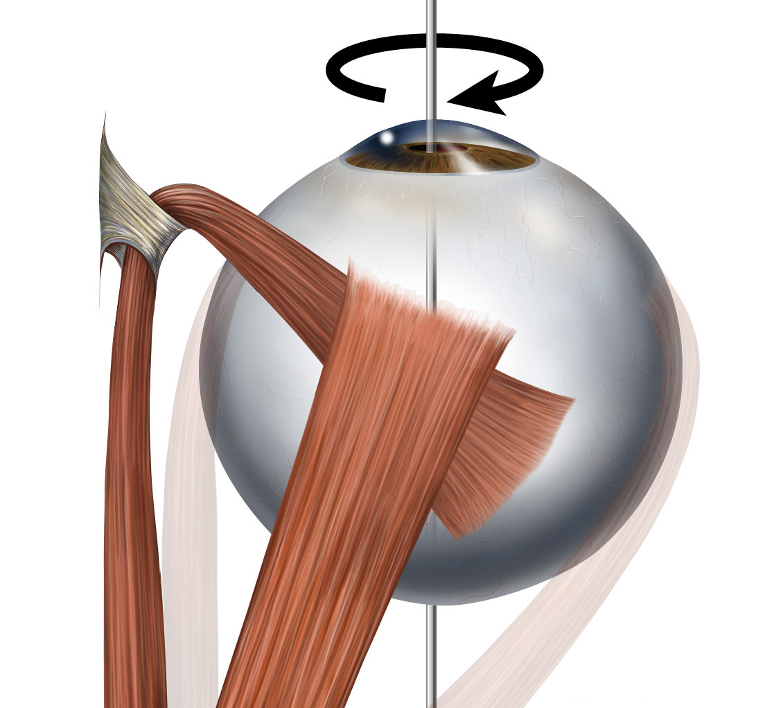 Superior Oblique Myomymia: Action of the Superior Oblique Muscle