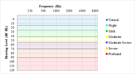 <p>Normal Hearing Ranges for Audiograms.</p>