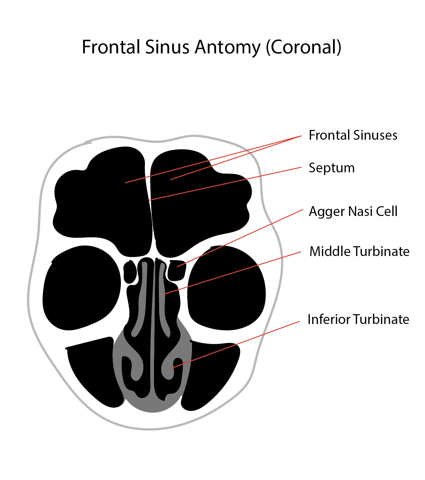 <p>Diagram of the Frontal Sinus Anatomy, Coronal View.</p>