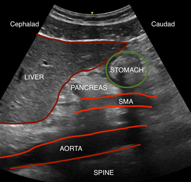 <p>Gastric Ultrasound, Anatomy