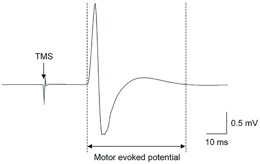 <p>Motor Evoked Potential Waveform</p>