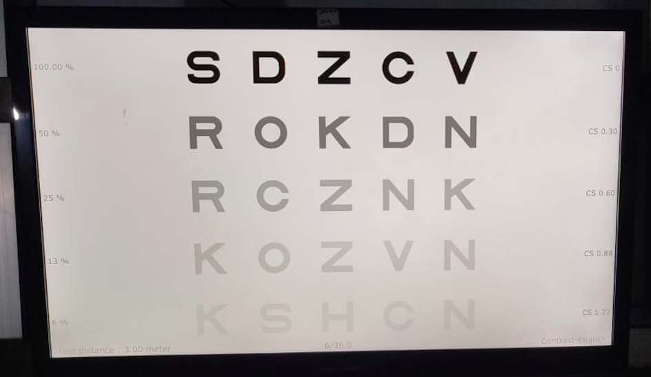 Digital image depicting Pelli-Robson contrast sensitivity chart