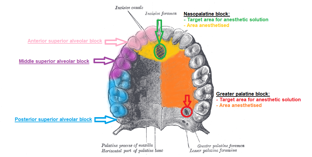 Maxillary blocks