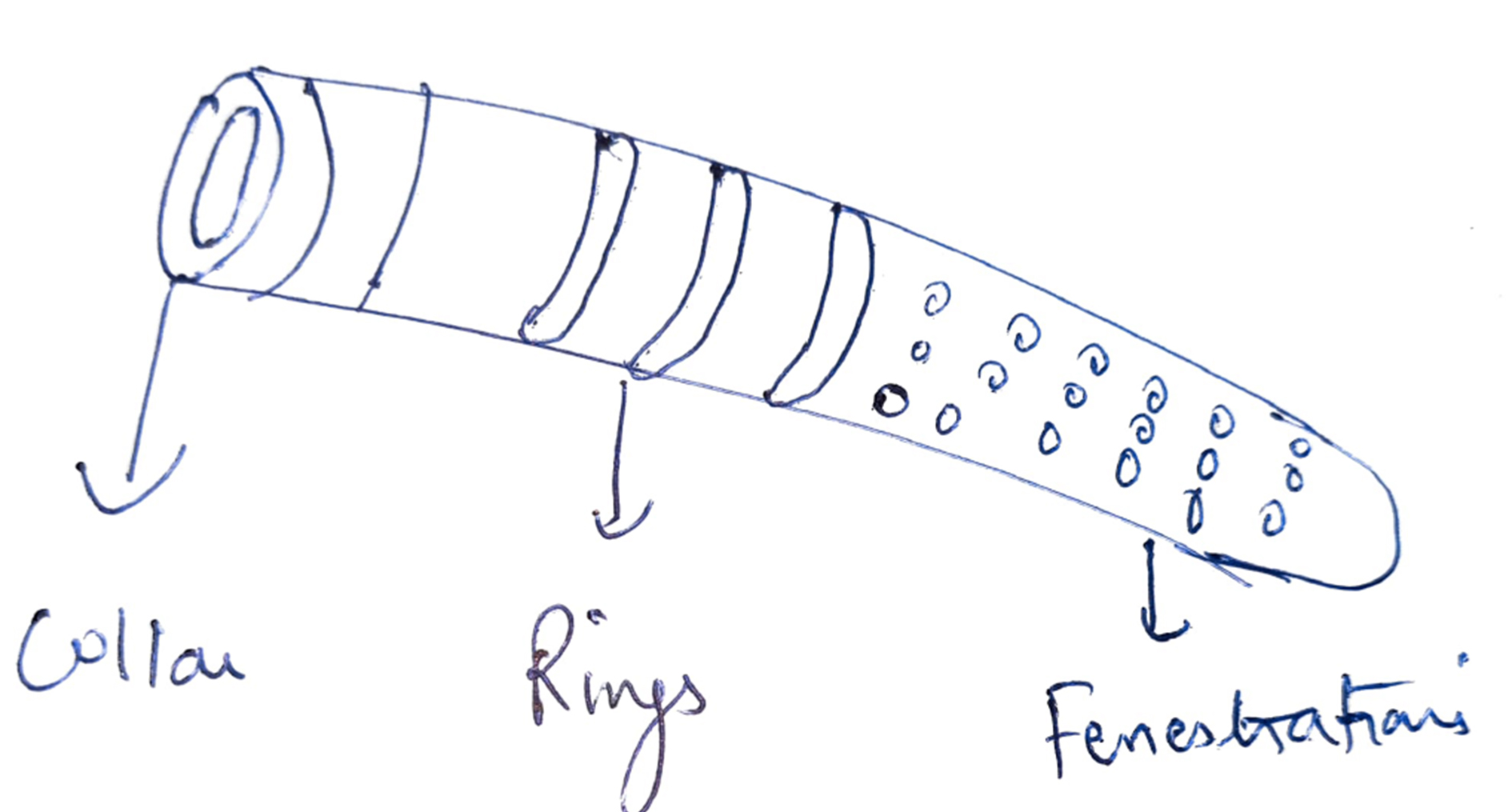 Cypass MIGS stent