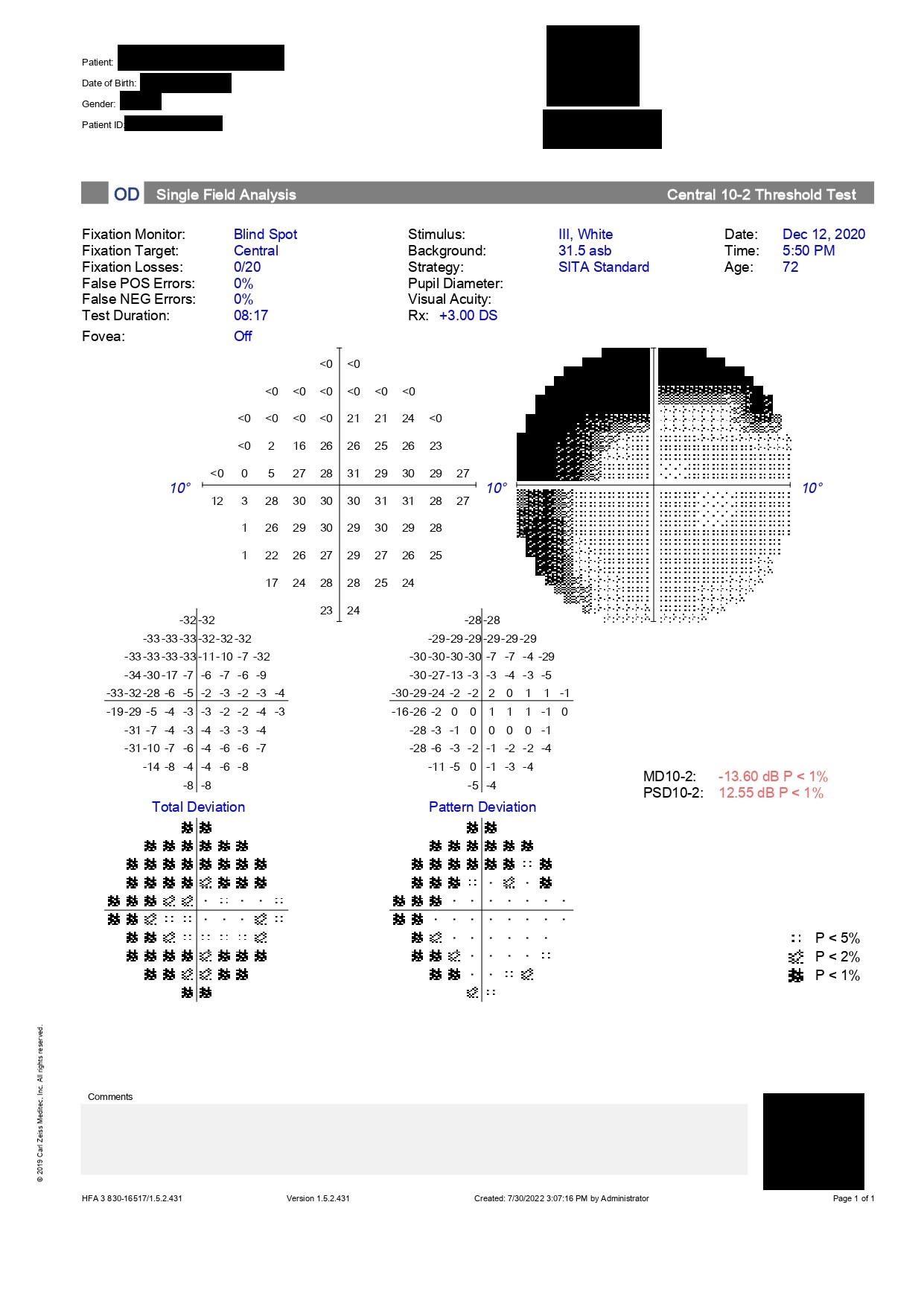 <p>Humphrey Visual Field Printout (10-2 Test)