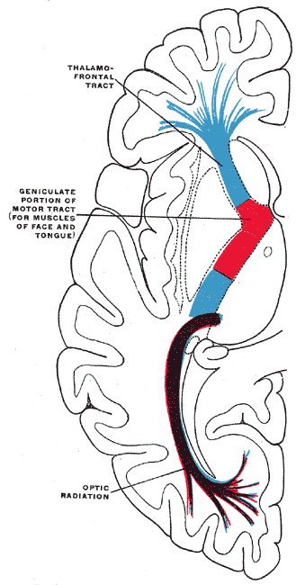 Diagram of the tracts in the internal capsule, Motor tract are red, The sensory tract is blue, the optic radiation (occipito 