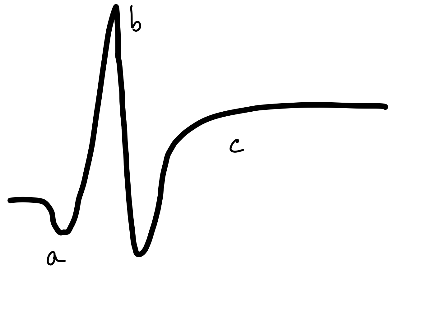 <p>Normal Electroretinogram.</p>