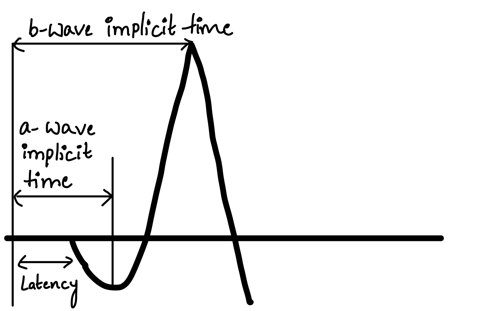 <p>Time Response of Electroretinogram Waves.</p>