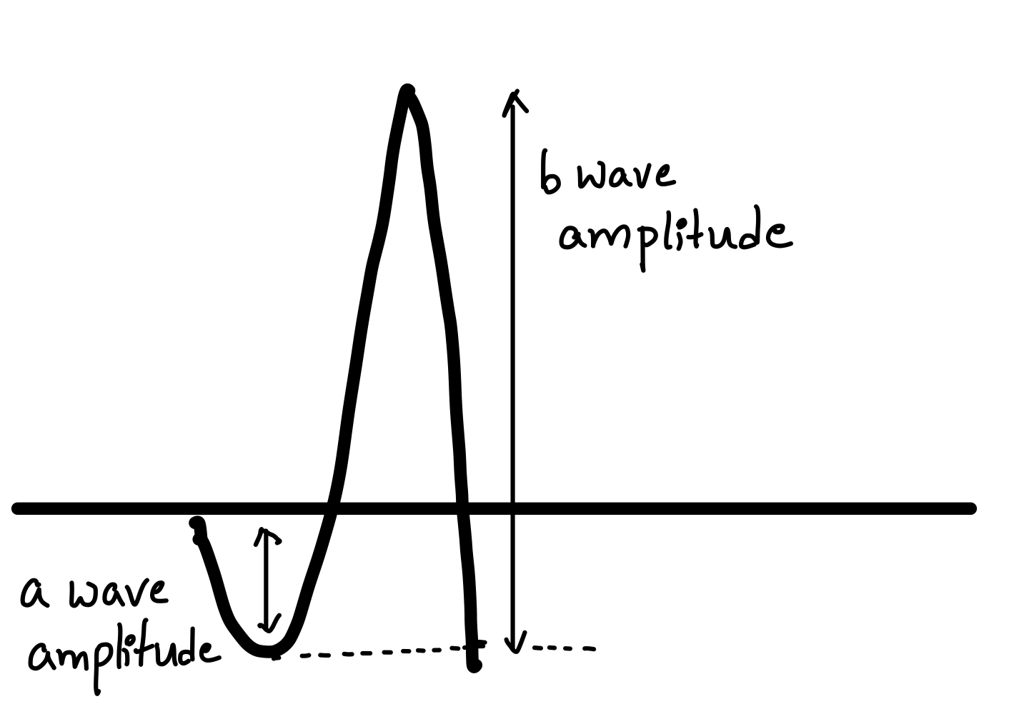 <p>Amplitude of Electroretinogram Waves.</p>