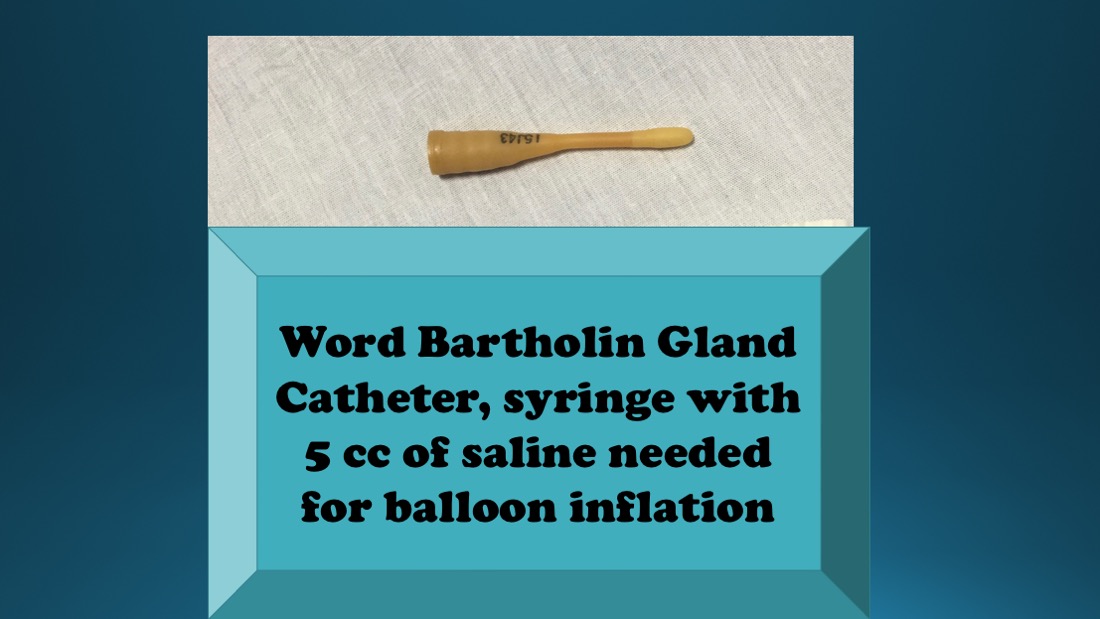 Bartholin Gland Word Catheter example used in the management of Bartholin cysts in some cases