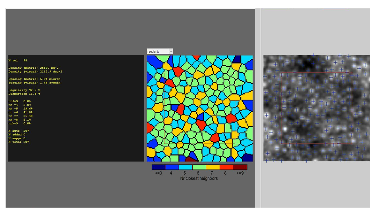 Cone cell counting with Adaptive optics