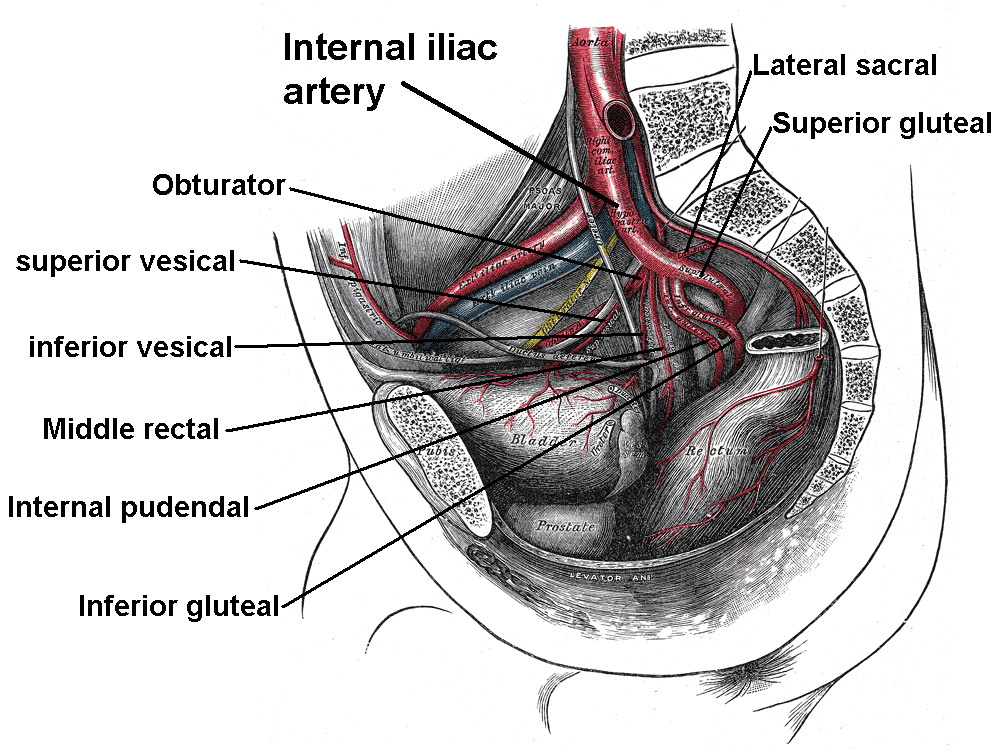 <p>Internal Iliac Branches