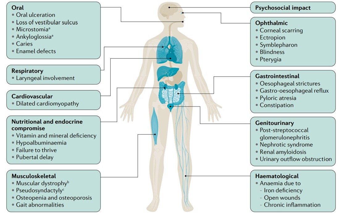 Extracutaneous manifestations of epidermolysis bullosa