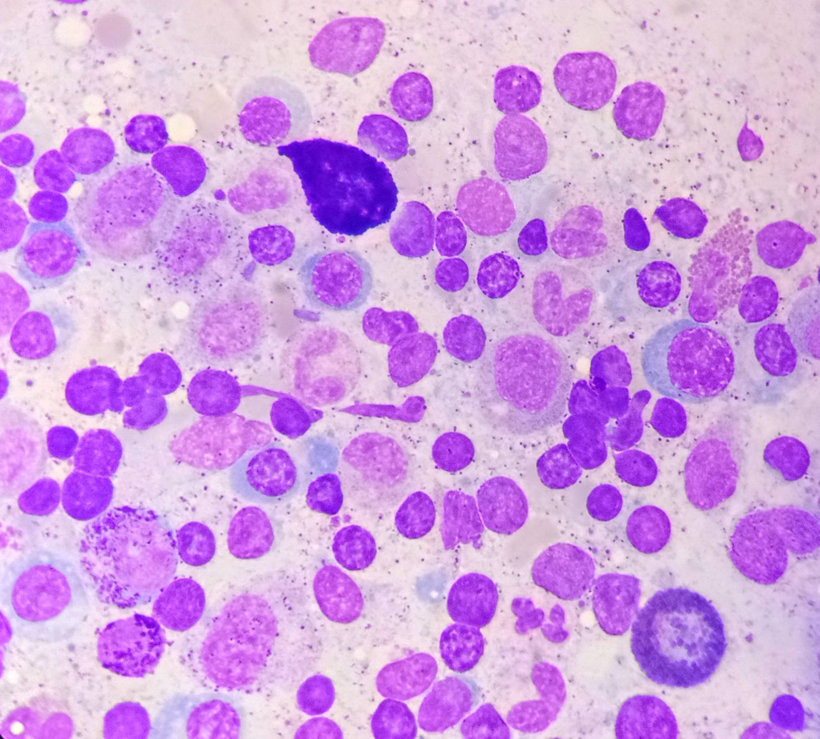 <p>Mast Cells