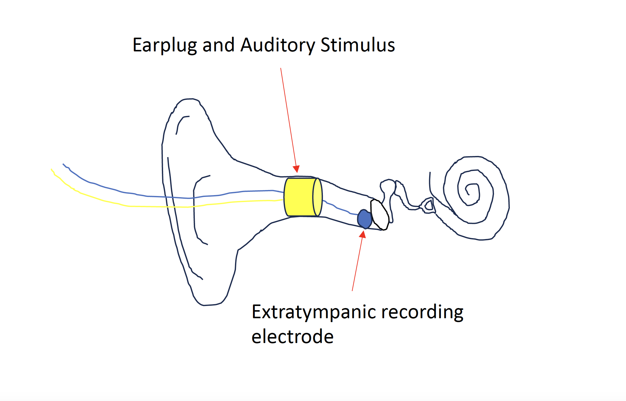 <p>Electrocochleography Diaphragm